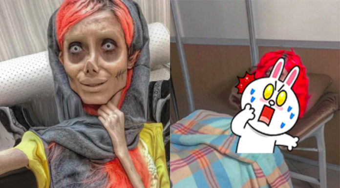 整形50次「殭屍裘莉」近況曝光!躺病床睜大眼:「我好美」