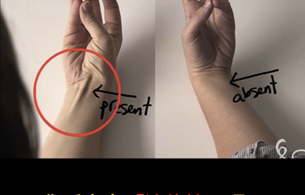 你或你身邊的人手腕有「這條筋」嗎?原來它竟是上天賜的禮物,全世界只有「這些人」才有···