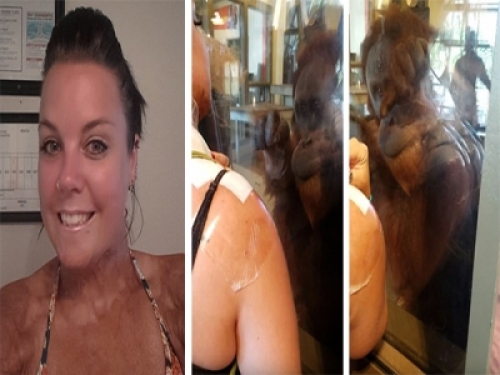 女子不幸被火燒過留下難看疤痕!紅毛猩猩看見她竟貼上玻璃「用手指向疤痕」!下一秒讓大家直呼不可思議!